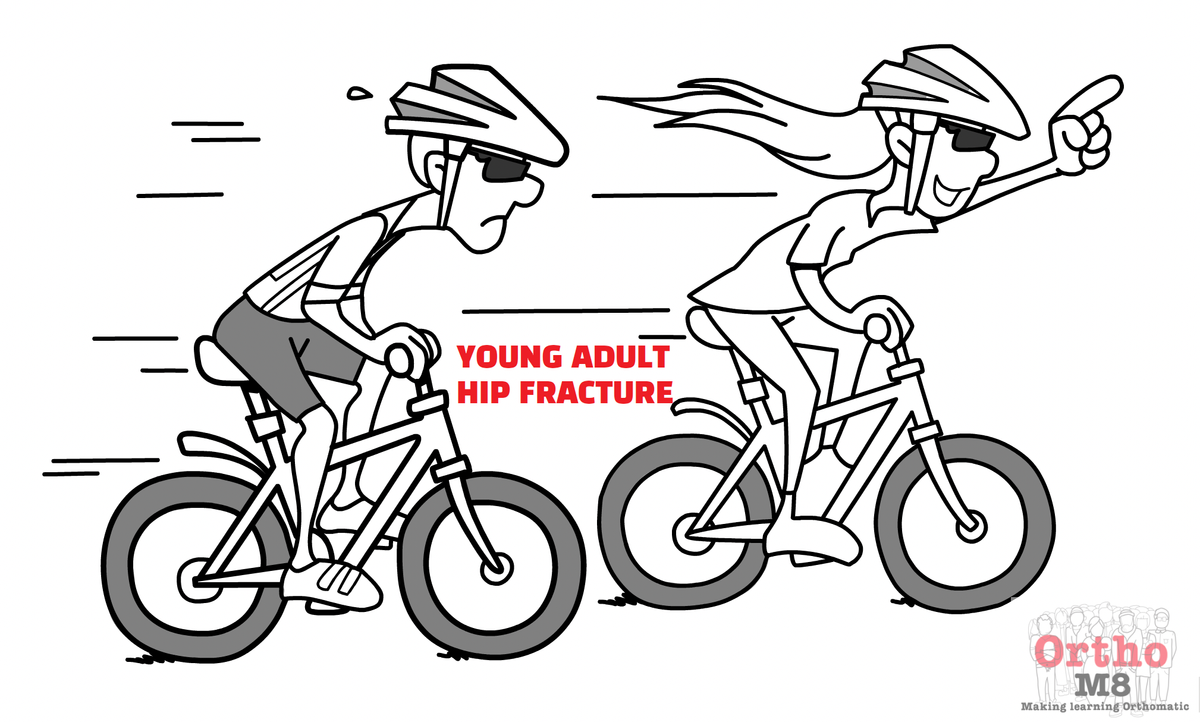 Young adult hip fracture